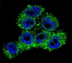 Confocal immunofluorescent analysis of TRPM8 antibody with A375 cells followed by Alexa Fluor 488-conjugated goat anti-rabbit lgG (green). DAPI was used as a nuclear counterstain (blue).