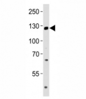 Western blot analysis of lysate from LNCaP cell line using TRPM8 antibody at 1:1000. Predicted molecular weight ~128 kDa.