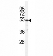 TUBB antibody western blot analysis in ZR-75-1 lysate.