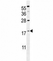 S100A4 antibody western blot analysis in mouse NIH3T3 lysate. Predicted molecular weight ~12 kDa.