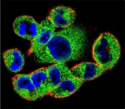 Confocal immunofluorescent analysis of SOCS4 antibody with A2058 cells followed by Alexa Fluor 488-conjugated goat anti-rabbit lgG (green). Actin filaments have been labeled with Alexa Fluor 555 Phalloidin (red). DAPI was used as a nuclear counterstain (blue).