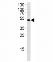 Western blot analysis of lysate from MCF-7 cell line using SOCS4 antibody diluted at 1:1000 for each lane. Predicted/observed molecular weigth ~51kDa.