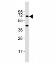 Western blot testing of TGFBR2 antibody at 1:2000 dilution + mouse lung lysate; Expected molecular weight ~65 kDa, routinely observed at 65-80 kDa.