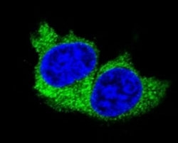 Confocal immunofluorescent analysis of MMP1 antibody with MDA-MB231 cells followed by Alexa Fluor 488-conjugated goat anti-rabbit lgG (green). DAPI was used as a nuclear counterstain (blue).