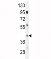 IRF9 antibody western blot analysis in mouse spleen tissue lysate. Predicted molecular weight: 44-48 kDa.