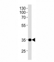 NKX1.1 antibody western blot analysis in SK-N-MC lysate.