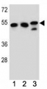 TUBB6 antibody western blot analysis in K562, HeLa, MDA-MB231 lysate.