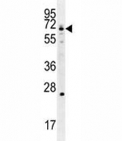 GCLC antibody western blot analysis in Jurkat lysate