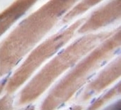 IHC testing of VEGFC antibody and FFPE human skeletal muscle.