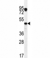 VEGFC antibody western blot analysis in MCF-7 lysate. Predicted molecular weight ~45 kDa.