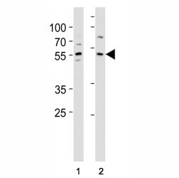 KLF4 antibody western blot analysis in (1) A431 and (2) MCF-7 lysate. Predicted molecular weight: 50-60 kDa + ~75 kDa