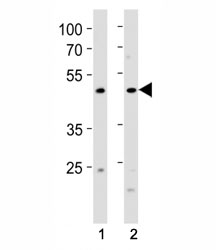 FOXA2 antibody western blot analysis in (1) human MCF-7 cell line and (2) rat stomach tissue lysate. Predicted molecular weight: 50 kDa.