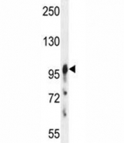 Axin-1 antibody western blot analysis in MDA-MB435 lysate. Predicted molecular weight: 95-110 kDa.