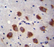 BMPR1B antibody immunohistochemistry analysis in formalin fixed and paraffin embedded human brain tissue.