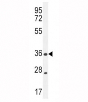 XCR1 antibody western blot analysis in MDA-MB435 lysate