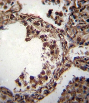 IHC staining of FFPE human lung tissue with TUBA1C antibody. HIER: boil tissue sections in pH6, 10mM citrate buffer, for 10-20 min and allow to cool before testing.
