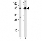 Western blot analysis of lysate from (1) mouse liver and (2) rat testis tissue lysate using TUBA1C antibody at 1:1000.