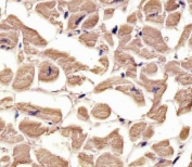 IHC staining of FFPE human heart tissue with TUBA1C antibody. HIER: boil tissue sections in pH6, 10mM citrate buffer, for 10-20 min and allow to cool before testing.