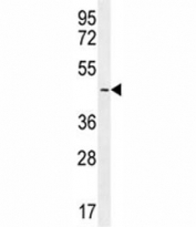LEF1 antibody western blot analysis in MDA-MB435 lysate.