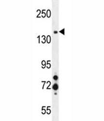 MET antibody western blot analysis in MDA-MB435 lysate.
