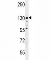 ZEB2 antibody western blot analysis in MDA-MB435 lysate. Predicted molecular weight  120~136 kDa.