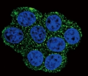 Confocal immunofluorescent analysis of SDHD antibody with HeLa cells followed by Alexa Fluor 488-conjugated goat anti-rabbit lgG (green). DAPI was used as a nuclear counterstain (blue).
