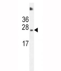 SDHD antibody western blot analysis in HeLa lysate