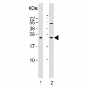 Western blot testing of human 1) A2058 and 2) HeLa cell lysate with SDHD antibody.