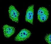 Confocal immunofluorescent analysis of PAK6 antibody with U-251MG cells followed by Alexa Fluor 488-conjugated goat anti-rabbit lgG (green). DAPI was used as a nuclear counterstain (blue).