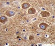 PAK6 antibody immunohistochemistry analysis in formalin fixed and paraffin embedded human brain tissue.