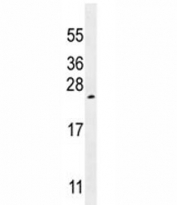 VEGF-A antibody western blot analysis in K562 lysate. Expected molecular weight 19~22 kDa (monomer) and 38~44 kDa (dimer). Banding may appear larger than predicted due to glycosylation.