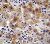 NEU2 antibody immunohistochemistry analysis in formalin fixed and paraffin embedded human liver tissue.
