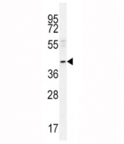 NEU2 antibody western blot analysis in A549 lysate. Predicted molecular weight ~42 kDa.