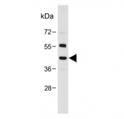 Western blot testing of human heart tissue lysate with NEU2 antibody. Predicted molecular weight ~42 kDa.