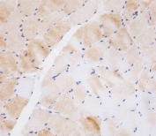 IHC testing of FFPE human skeletal muscle tissue with NEU2 antibody. HIER: steam section in pH9 EDTA for 20 min and allow to cool prior to staining.
