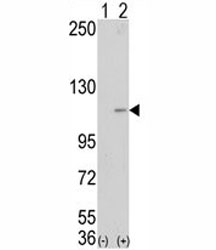 Western blot analysis of LSD1 antibody and 293 cell lysate (2 ug/lane) either nontransfected (Lane 1) or transiently transfected with the AOF2 gene (2).~