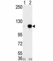 Western blot analysis of LSD1 antibody and 293 cell lysate either nontransfected (Lane 1) or transiently transfected with the AOF2 gene (2). Expected molecular weight ~110kDa.