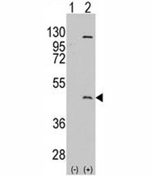 Western blot analysis of PRMT8 antibody and 293 cell lysate either nontransfected (Lane 1) or transiently transfected