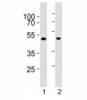 Western blot analysis of lysate from 1) human brain and 2) mouse brain tissue lysate using PRMT8 antibody at 1:1000.