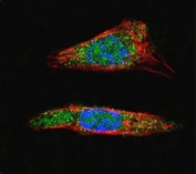 Confocal immunofluorescent analysis of SUMO1 antibody with A375 cells followed by Alexa Fluor 488-conjugated goat anti-rabbit lgG (green). Actin filaments have been labeled with Alexa Fluor 555 Phalloidin (red). DAPI was used as a nuclear counterstain (blue).