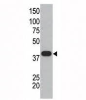 SUMO polyclonal antibody used in western blot to detect GST-SUMO1 fusion protein. Predicted molecular weight: 12-15 kDa + 25 kDa GST tag.