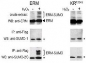 COS-7 cells were transfected for 24 hrs with a plasmid expressing FLAG-ERM (left panels) or FLAG-ERM KR12345 (right panels). Top: lysate tested with ERM Ab. Center: IP with FLAG Ab followed by WB with NSJ# F42008 SUMO antibody. Bottom: IP with FLAG Ab followed by WB with NSJ# F42027 SUMO-2/3 antibody. (*) represents immunoprecipitated ERM-like forms detected by SUMO Abs.