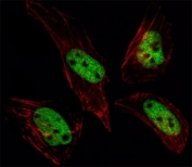 Fluorescent image of HeLa cells stained with SUMO antibody at 1:25. SUMO1 immunoreactivity is localized to the nucleus.