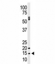 Western blot analysis of SUMO antibody and A375 lysate. Predicted molecular weight: 12-15 kDa