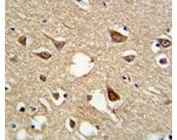 IHC analysis of FFPE human brain tissue stained with SUMO1 antibody