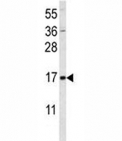 Western blot analysis of SUMO1 antibody and MCF-7 lysate. Predicted molecular weight: 12-15 kDa
