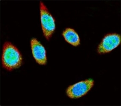 Confocal immunofluorescent analysis of SUMO1 antibody with A375 cells followed by Alexa Fluor 488-conjugated goat anti-rabbit lgG (green). Actin filaments have been labeled with Alexa Fluor 555 Phalloidin (red). DAPI was used as a nuclear counterstain (blue).