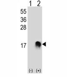 Western blot analysis of SUMO-2 antibody and 293 cell lysate (2 ug/lane) either nontransfected (Lane 1) or transiently transfected (2)
