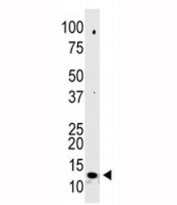 Western blot analysis of SUMO-2 antibody and 293 cell lysate. Observed molecular weight: 12-15 kDa.