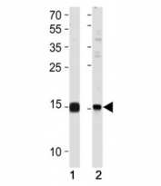 SUMO2/3 antibody western blot analysis in (1) 293 and (2) HeLa lysate
